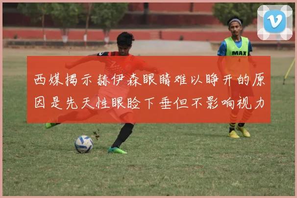西媒揭示赫伊森眼睛难以睁开的原因是先天性眼睑下垂但不影响视力